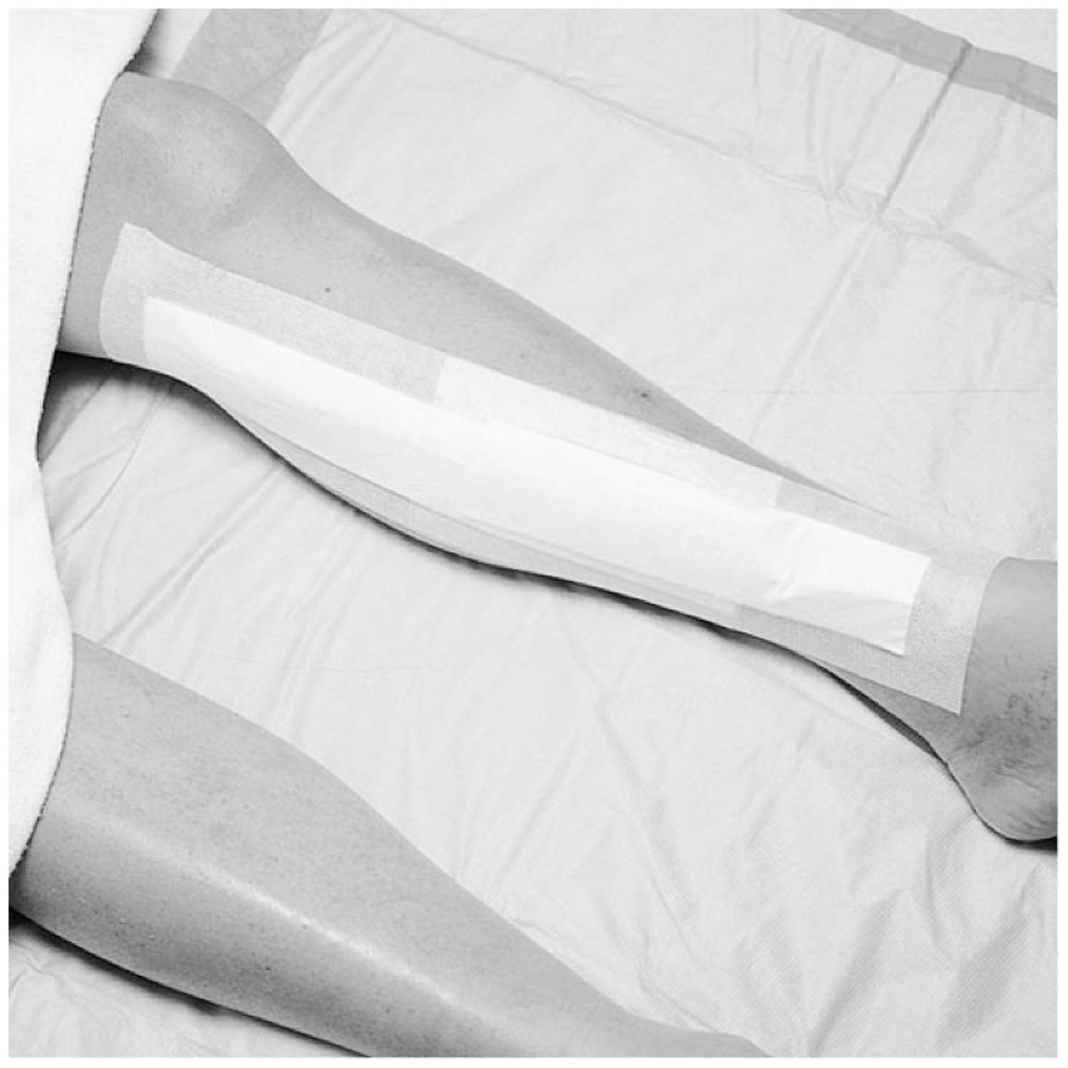 SOLVENTUM MEDIPORE™ +pad SOFT CLOTH ADHESIVE WOUND DRESSING "Wound Dressing, 31/2\" x 4\", Pad Size 13/4\" x 2-3/8\", 25/bx, 4 bx/cs "